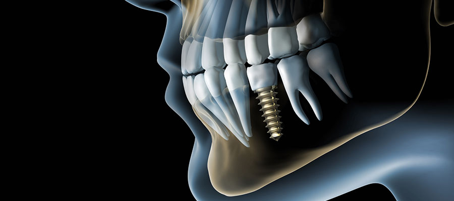 Быстрый 3D рентген зуба: современные технологии в стоматологии